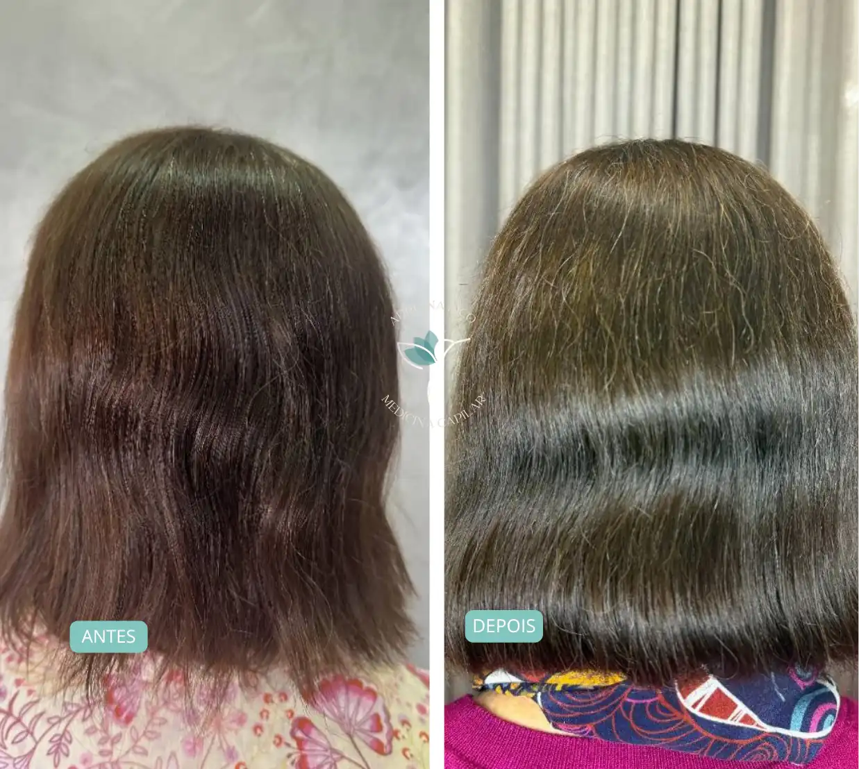 antes-depois-01