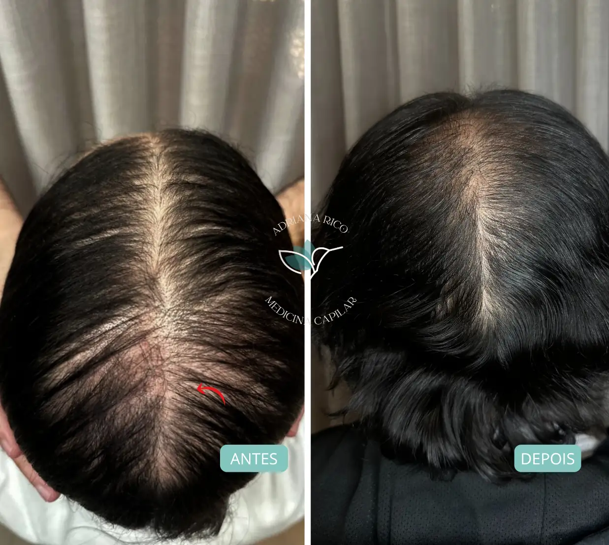 antes-depois-02