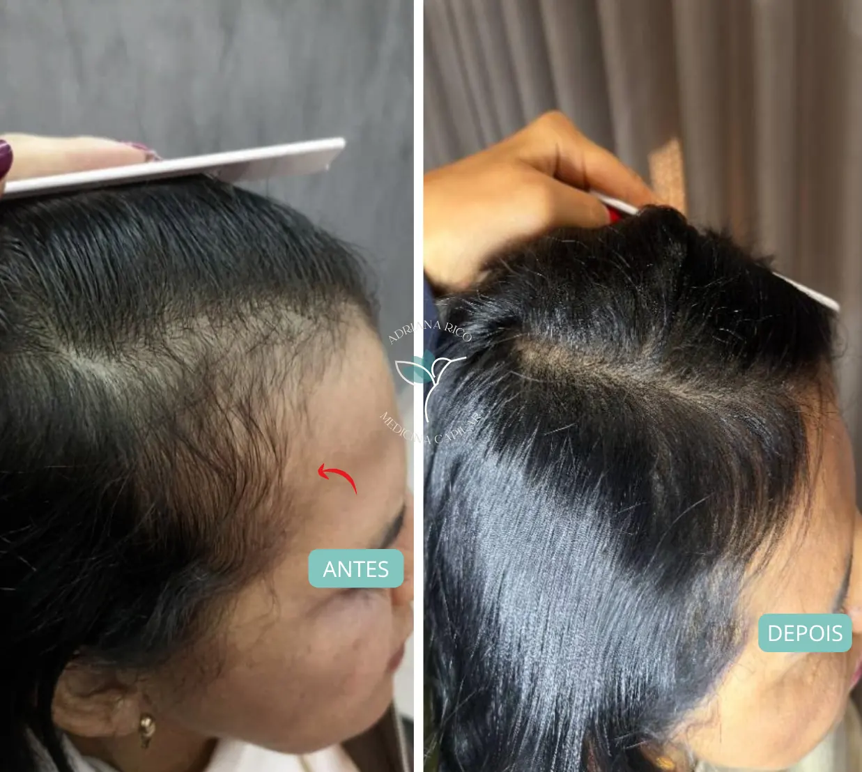 antes-depois-03