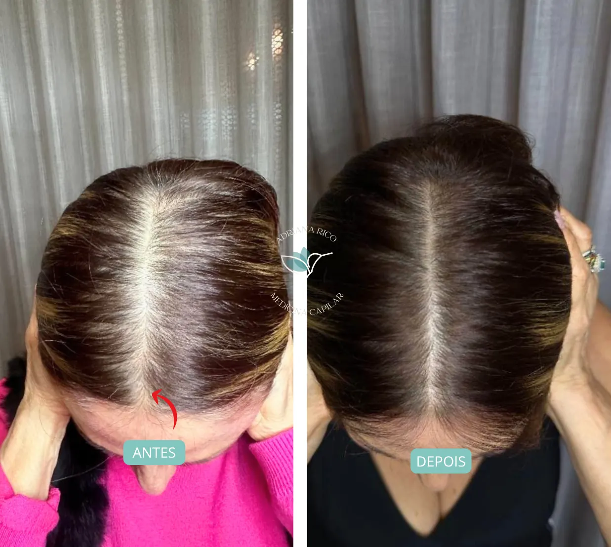 antes-depois-04
