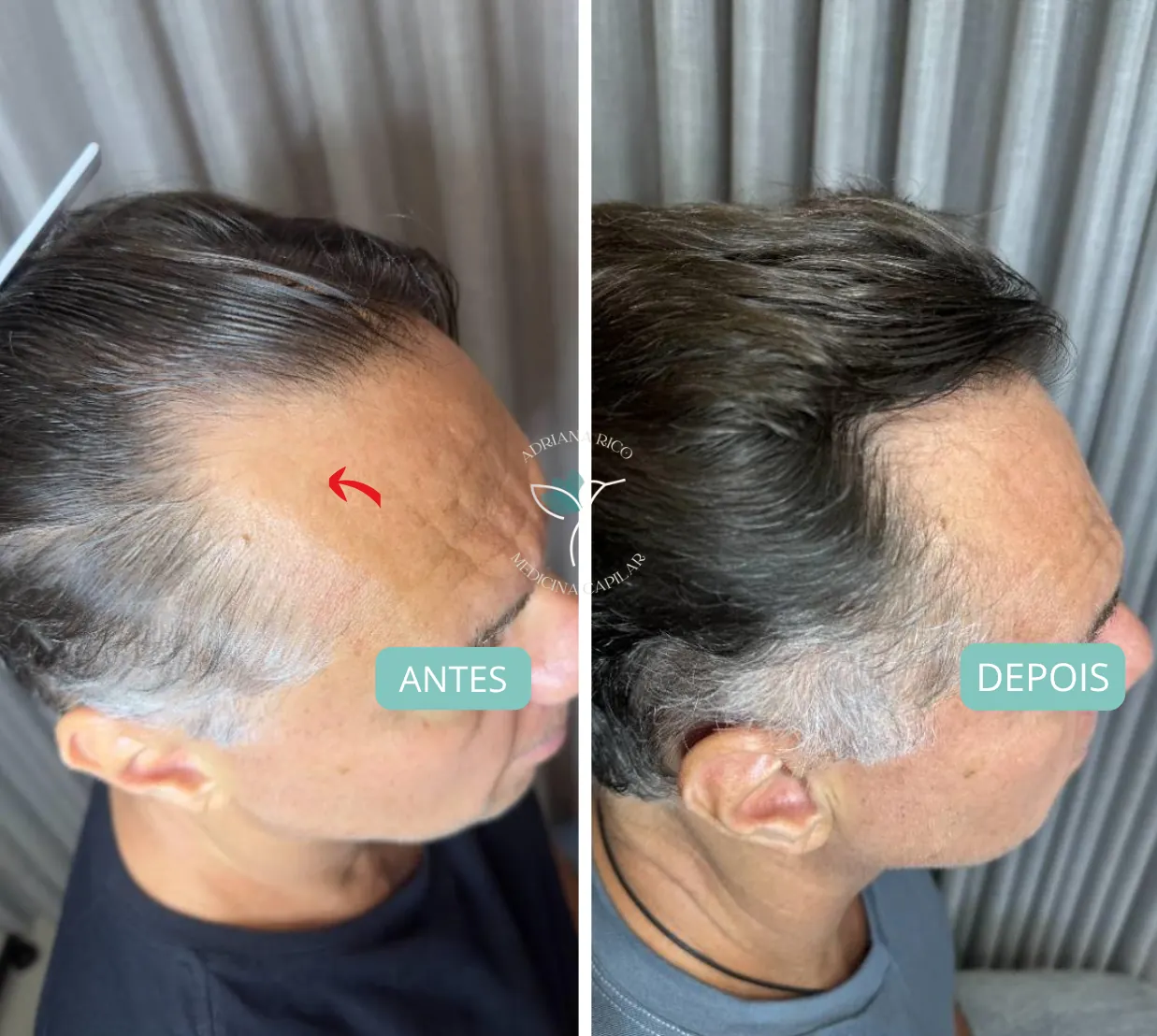 antes-depois-06
