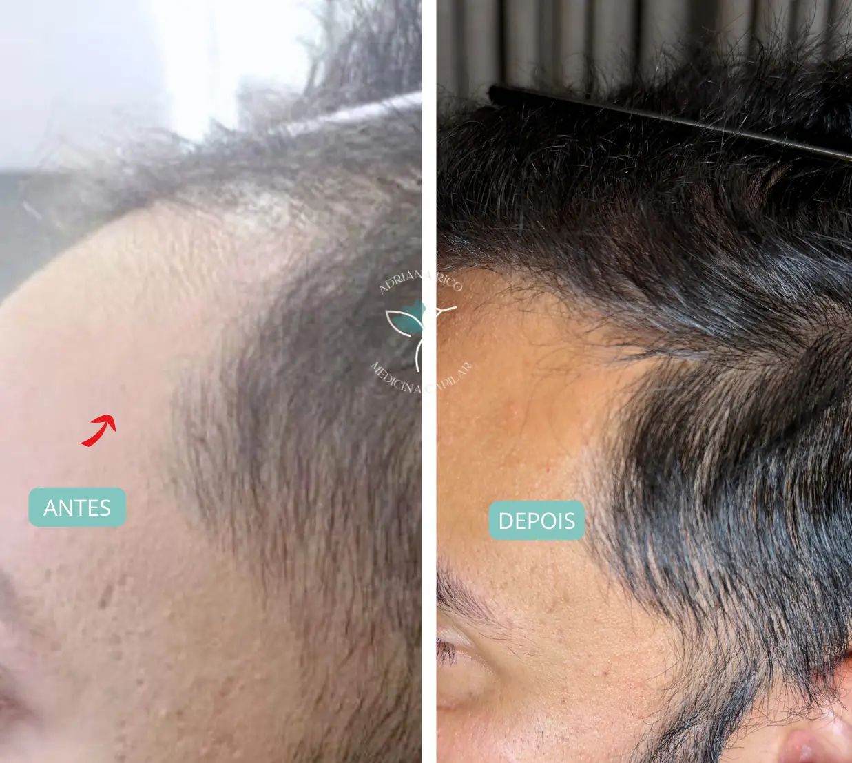 antes-depois-07