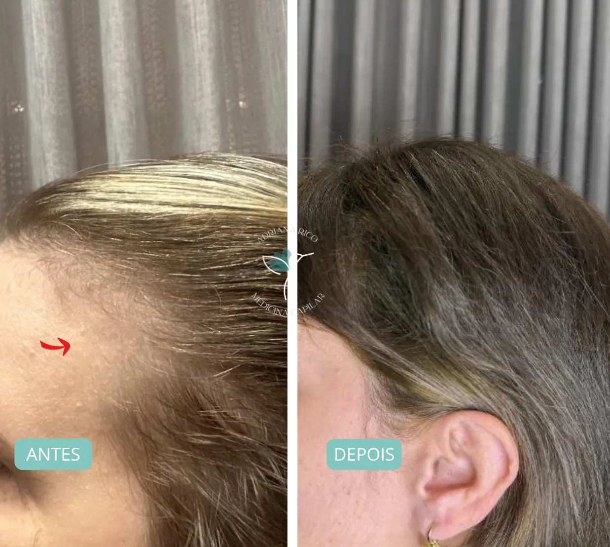 antes-depois-08