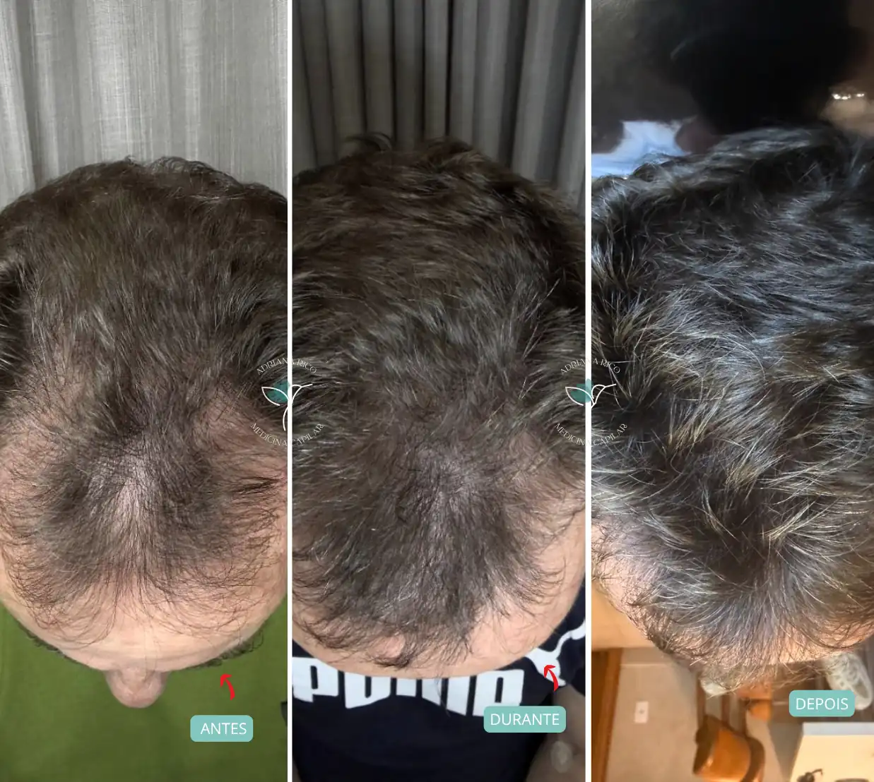 antes-depois-09