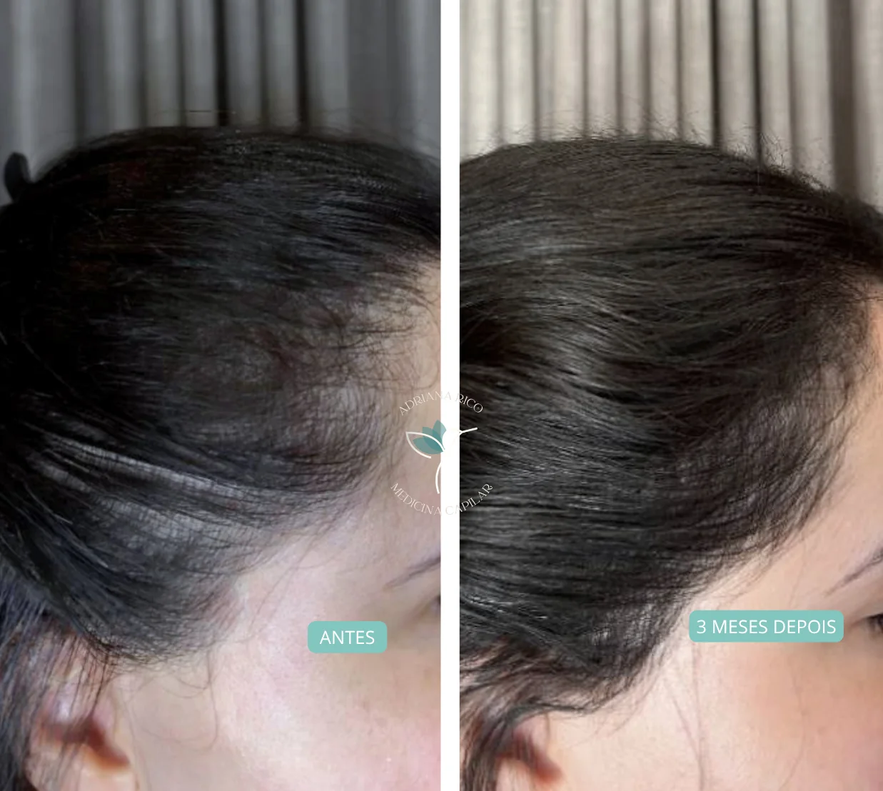 antes-depois-11