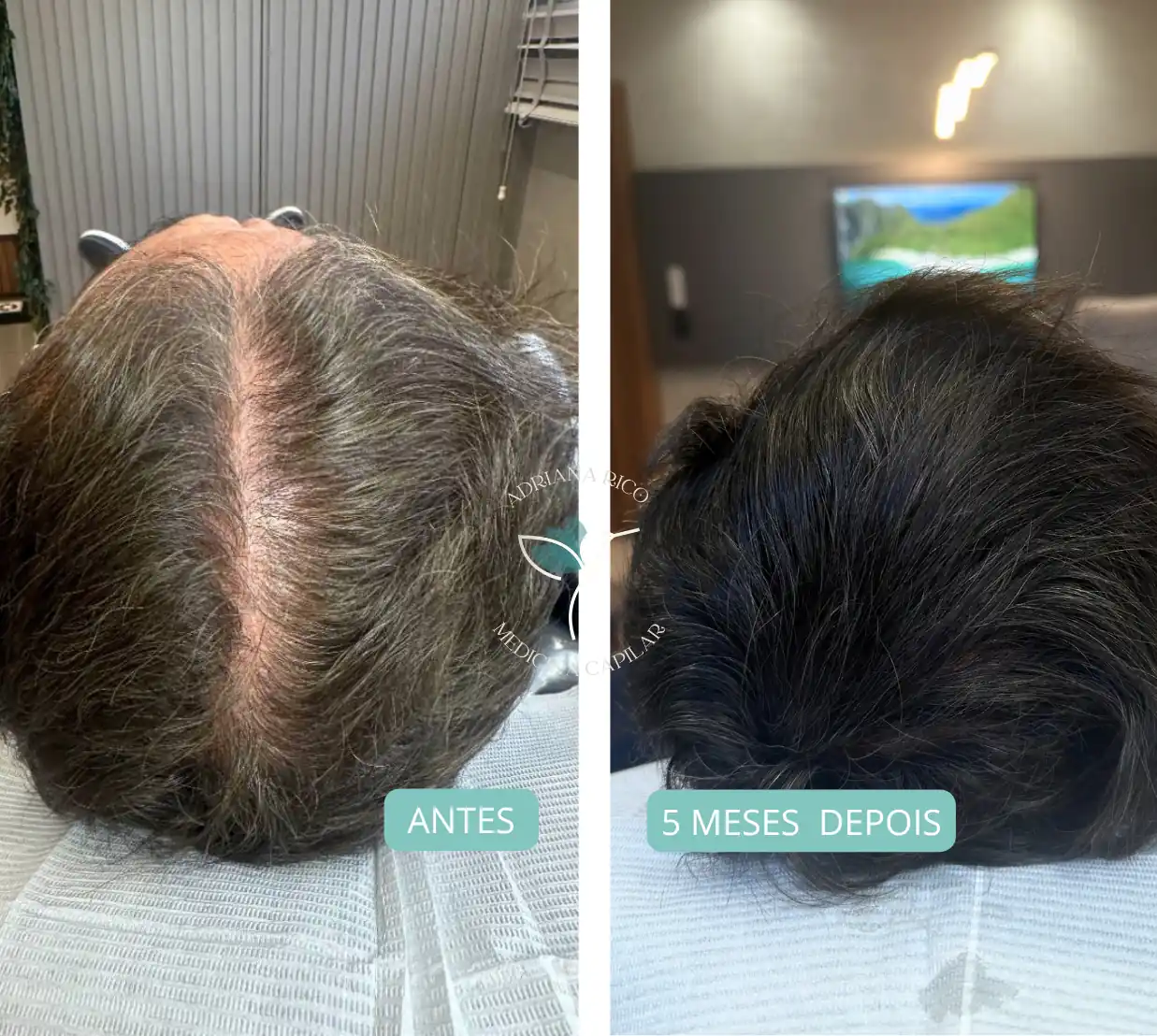 antes-depois-12