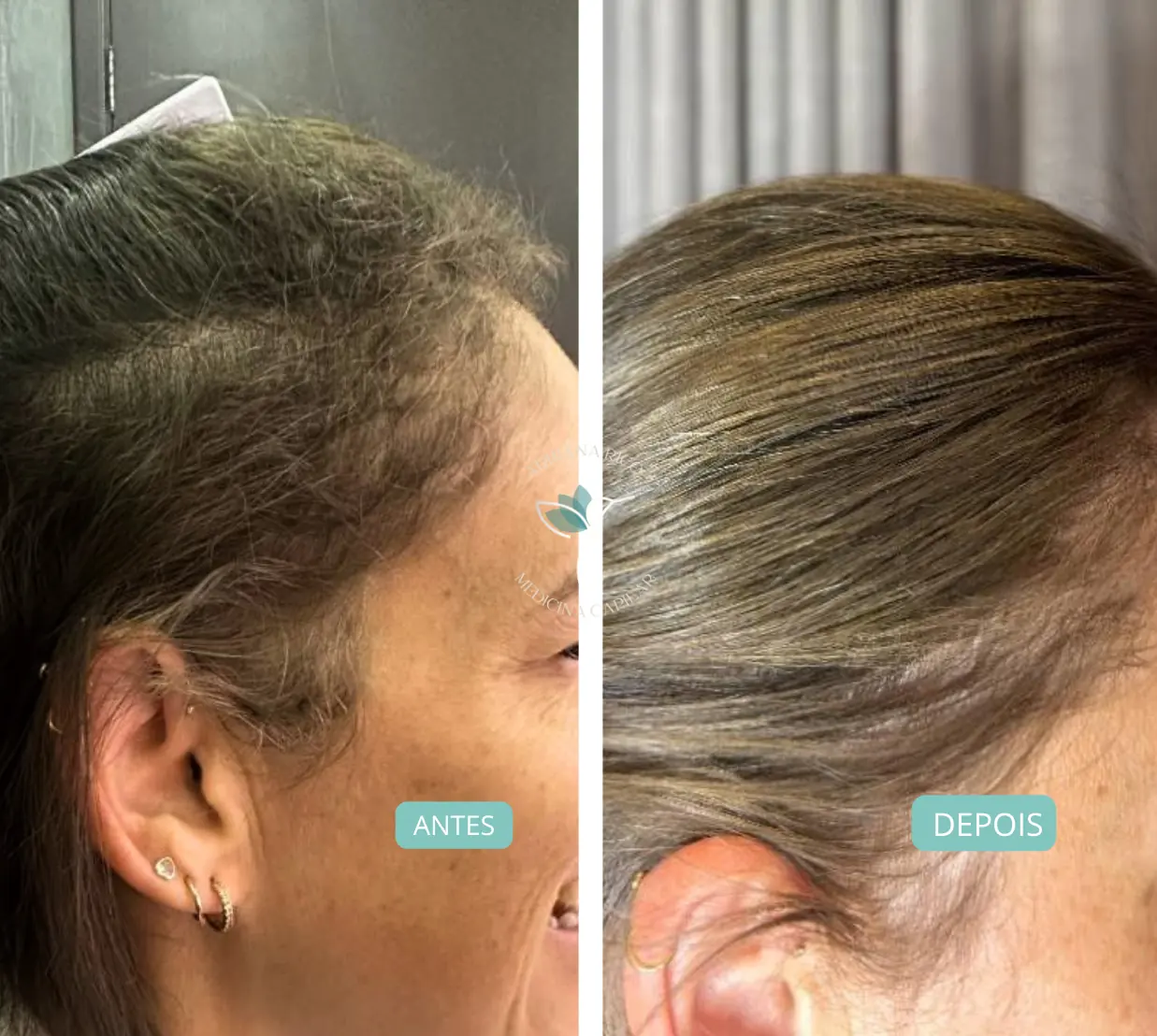 antes-depois-13