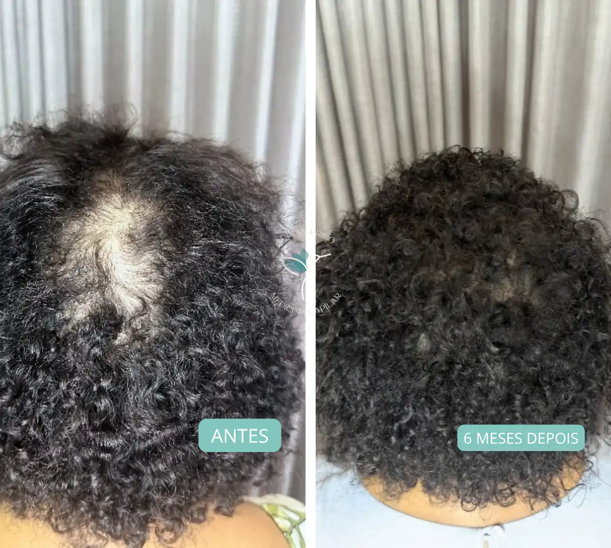 antes-depois-14