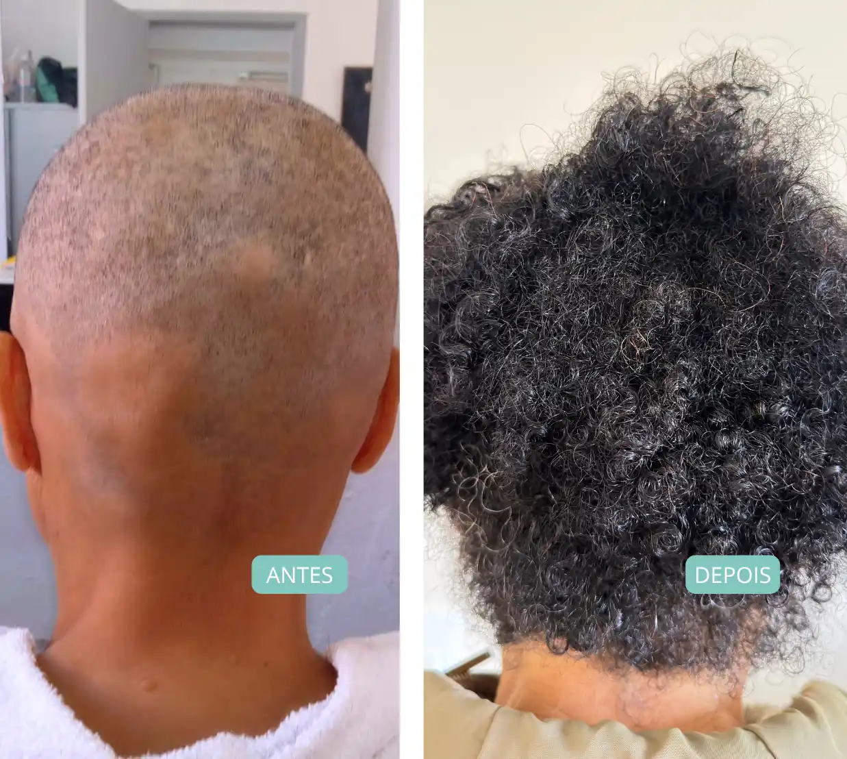 antes-depois-16