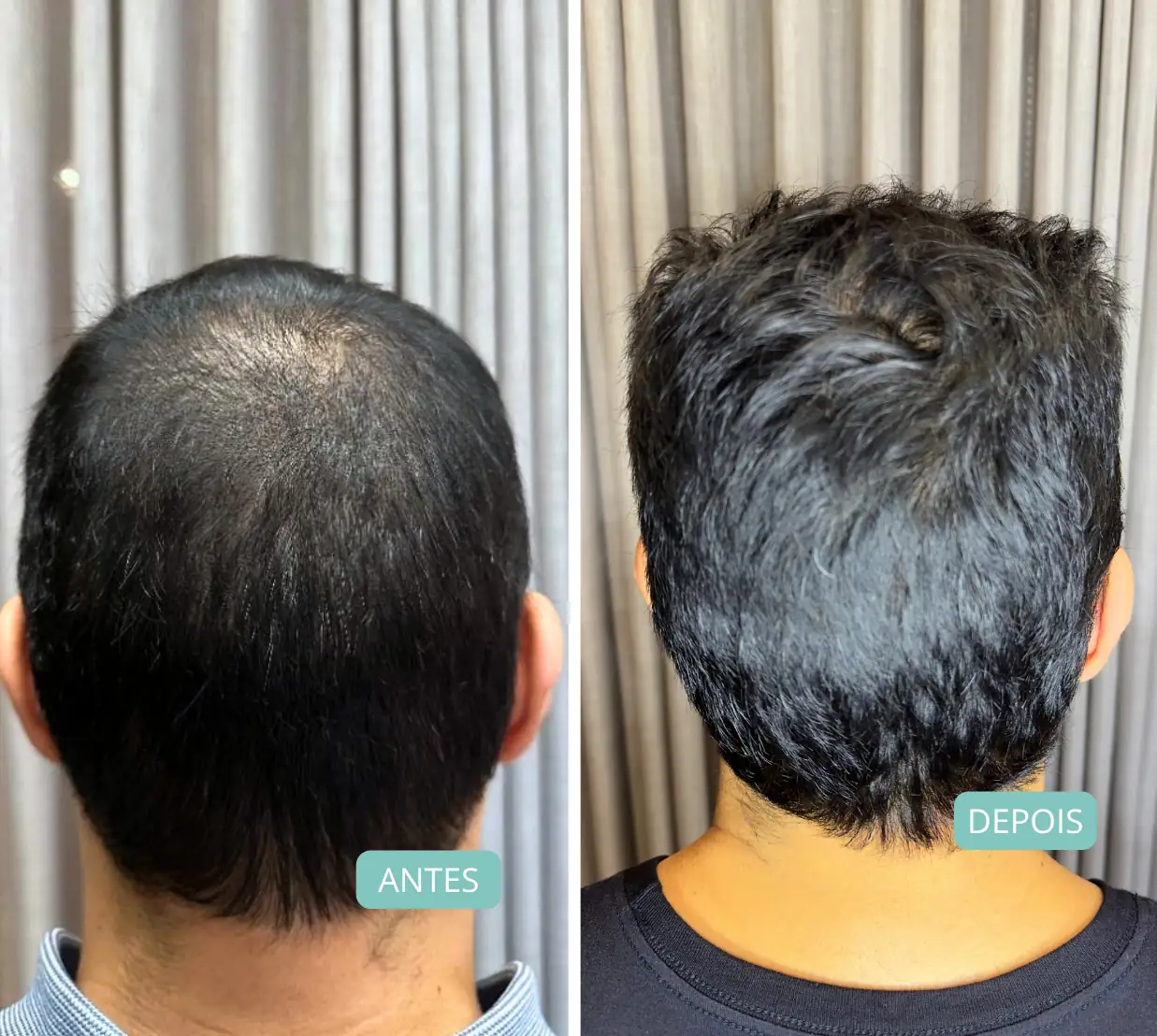 antes-depois-17