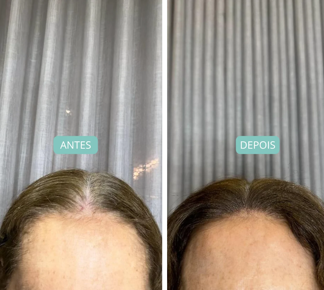 antes-depois-18